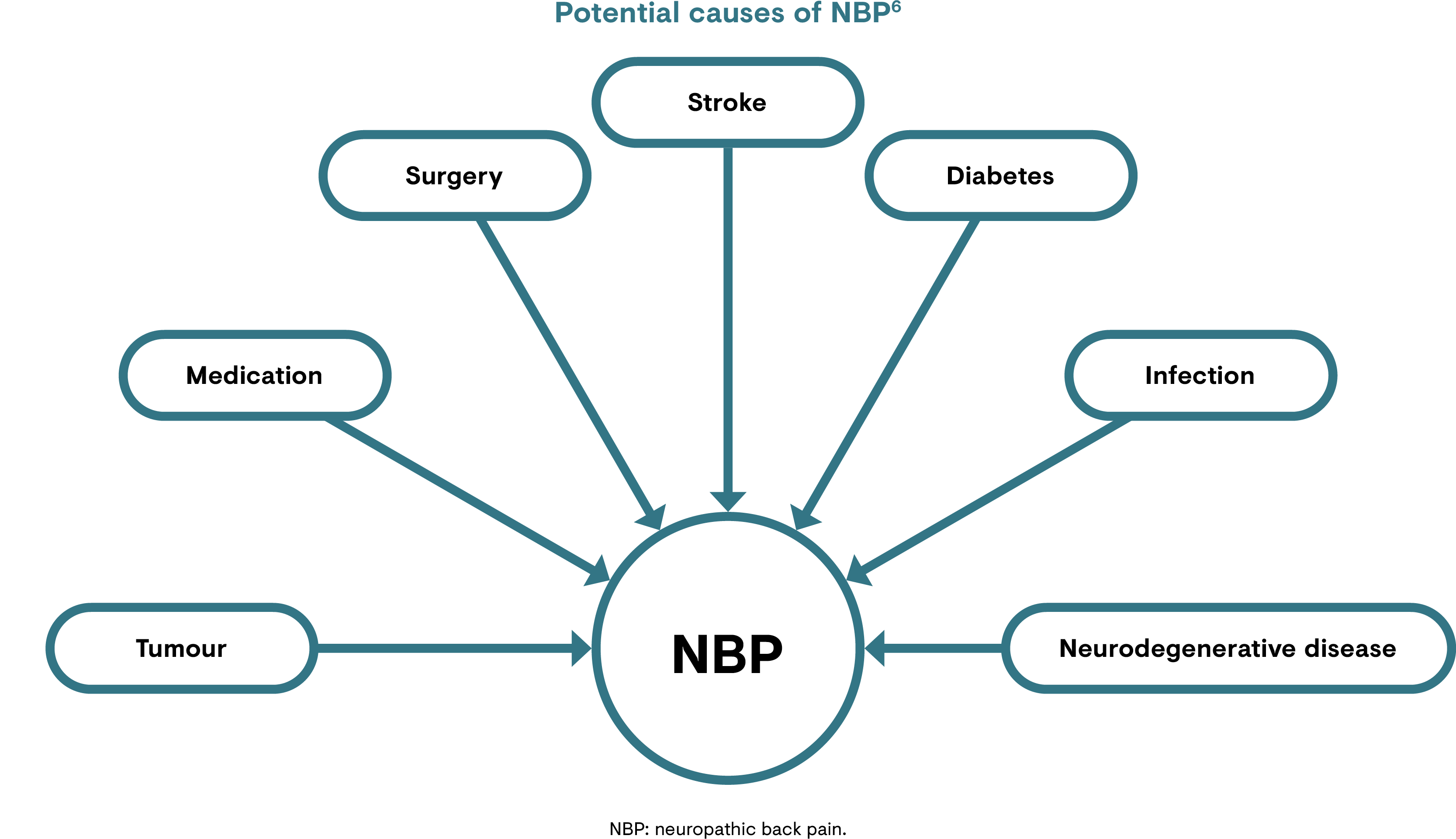 Potential causes of neuropathic back pain (NBP)